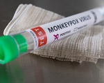 Should you worry about monkeypox?
