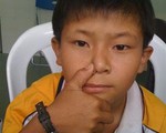 Cầm máu khi trẻ chảy máu mũi