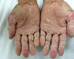 Bệnh lạ do nhiễm độc từ môi trường?