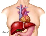 Thêm một bệnh nhi được ghép gan thành công