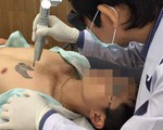 Hình xăm càng đẹp, xóa càng khó phai