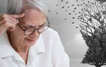 Gần 80% người sa sút trí tuệ mắc Alzheimer, phát hiện sớm có khó không?