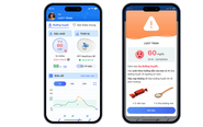 Ra mắt sản phẩm máy đo đường huyết liên tục 3P