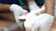 Video: Bó bột, chữa trị cho rắn hổ mang chúa bị gãy 4 xương sườn