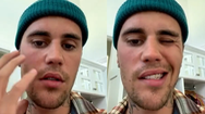 Video: Căn bệnh khiến ca sĩ Justin Bieber bị liệt nửa mặt nguy hiểm thế nào?