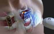 Nghiên cứu mới giúp sạc pin máy tạo nhịp tim mà không cần phẫu thuật