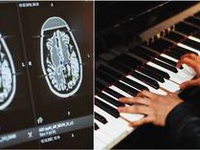 Kỳ lạ nghệ sĩ chơi piano trong khi được phẫu thuật não