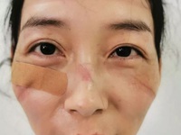 Bác sĩ ở Vũ Hán phải mặc tã làm việc, bị đánh và thiếu tiếp tế