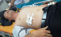 Học sinh đâm thủng bụng thầy đã vào bệnh viện xin lỗi Học sinh đâm thủng bụng thầy đã vào bệnh viện xin lỗi