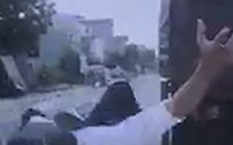 Chàng trai hú hồn khi bị ôtô tông nằm ngửa trên yên xe máy
