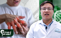Món ăn chứa nhiều đạm có phải là nguyên nhân gây bệnh gout?