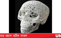 Trung Quốc: in hộp sọ 3D giúp chữa bệnh nguy hiểm về sọ