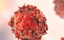 Tế bào não vô tình tiếp tay cho ung thư tuyến tụy