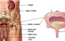 Không vô nhà vệ sinh kịp thì són tiểu là bệnh gì?