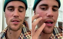 Justin Beiber 'ngừng hát' để tập trung trị chứng liệt nửa mặt