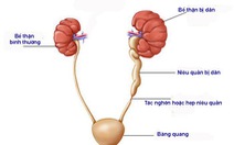 Những giải pháp tích cực khi bị thận ứ nước