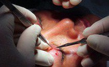 Sở Y tế Hà Nội vào cuộc vụ ‘cắt mí mắt tại spa’