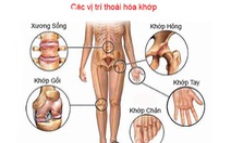 Thuốc điều trị, hỗ trợ trong bệnh lý về khớp