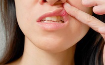 Các bệnh trong khoang miệng thường gặp