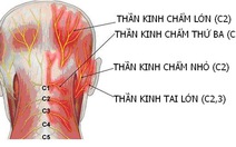 Đau dây thần kinh chẩm