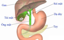 Những điều cần biết sau khi cắt túi mật