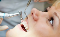 Khi nào nên lấy cao răng?