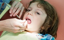 Chăm sóc hệ răng sữa cho bé