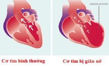 Căn bệnh nào được xem là 'ung thư của tim'?