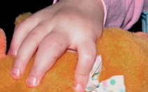 Bệnh xương khớp có thể gặp ở cả trẻ em và người lớn