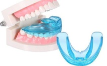 Răng trẻ mọc lệch, có nên dùng hàm nhựa điều chỉnh?