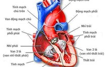 Bệnh tim bẩm sinh ở trẻ em