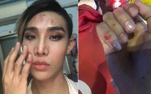Người mẫu The Face tố bị tài xế Go Viet 'đánh vào mặt và bóp cổ'