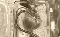 Đột phá: hồi sinh tim của người đã chết để ghép tạng