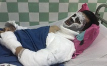 Việt kiều bị tạt axít, cắt gân chân: Công an thu được một clip quan trọng
