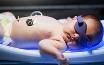 Biểu hiện vàng da ở trẻ sơ sinh báo hiệu bệnh lý nguy hiểm