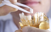 Lắp răng giả có gây ung thư miệng?