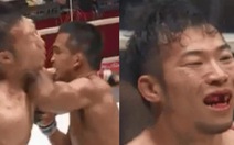 Võ sĩ MMA Nhật bị đối thủ Thái Lan đánh văng răng cửa