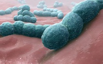Vi khuẩn giết chết con người - Thiệt hại hơn một vụ cố sát