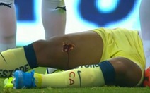 Video cựu cầu thủ Barca bị đối thủ đạp thủng đùi