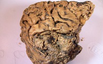 Kinh ngạc mô não người vẫn ‘còn nguyên’ sau 2.600 năm