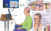 Kết nối não người với máy tính qua… mạch máu