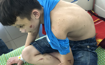 Vụ bé trai bị bạo hành: Hàng xóm có nghi ngờ nhưng không ai để ý
