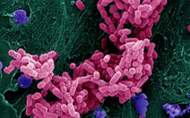 Khám phá ra cách vi khuẩn 'đấu' với kháng sinh