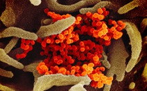 Virus corona tàn phá cơ thể người ra sao?