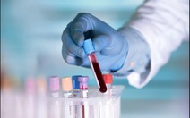 Nghiên cứu mới ở Trung Quốc: người nhóm máu A dễ mắc COVID-19