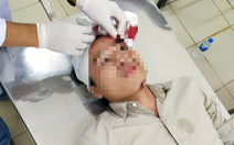 Nhóm côn đồ cầm dao vào trạm Cù Đinh đánh một kiểm lâm viên nhập viện