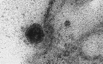 Lần đầu ghi được khoảnh khắc virus corona tấn công tế bào