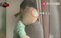 Trung Quốc điều tra vụ trẻ đầu to, còi xương vì uống 'sữa đặc biệt'