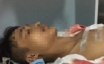 Hà Giang: Điều tra vụ việc một học sinh bị đâm tại cổng trường