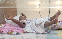 Rốn bé có chồi, có hạt, tại sao?